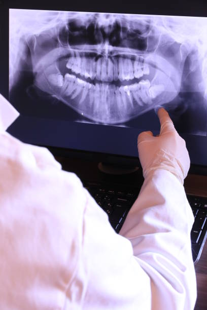 Best Walk-In Emergency Dentist in Spooner, WI